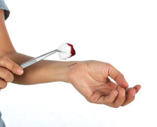 doctor cleaning wound area of injured patient